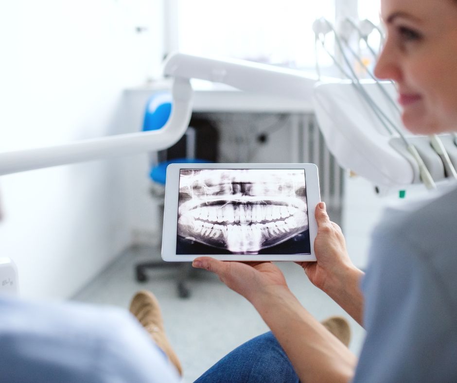 Oakton Family Dentistry - Benefits of Digital Dental X-Rays