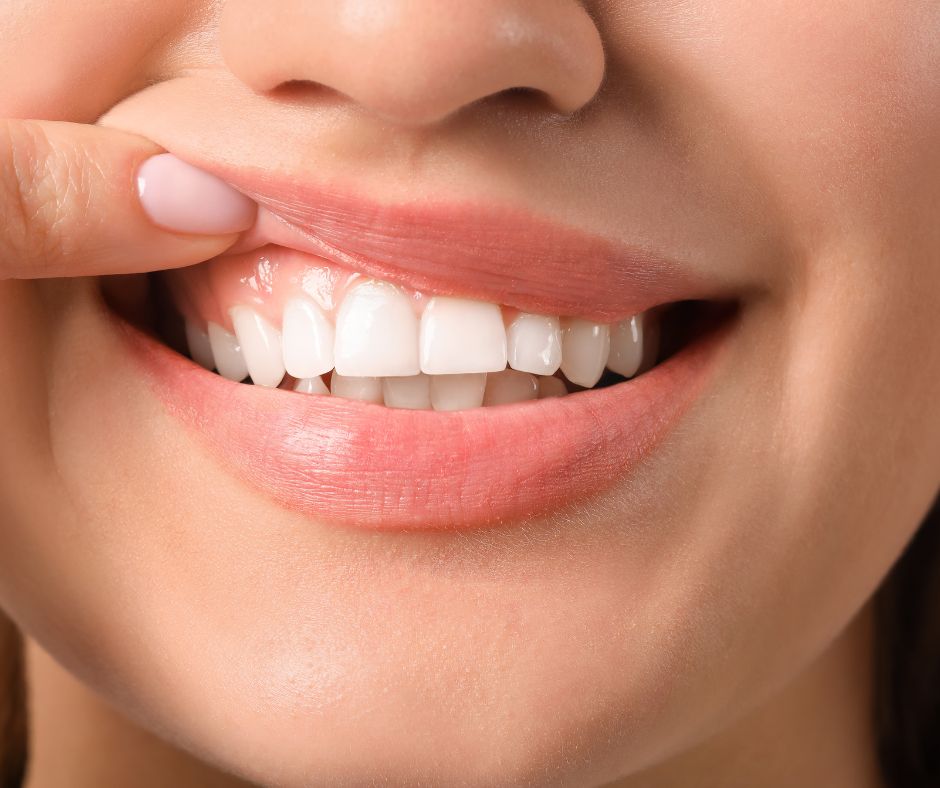 Oakton Family Dentistry - Treatment for Gum Recession in Fairfax