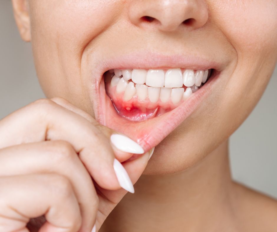 Oakton Family Dentistry - Gum Disease Treatment in Fairfax