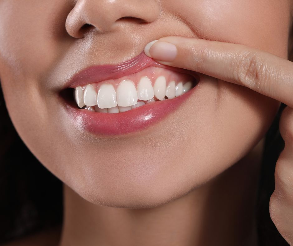 Oakton Family Dentistry - What to Know About Gingivitis Symptoms in Fairfax