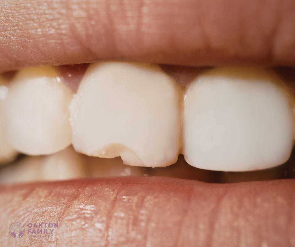 Oakton Family Dentistry - Cosmetic Dentist in Fairfax, VA